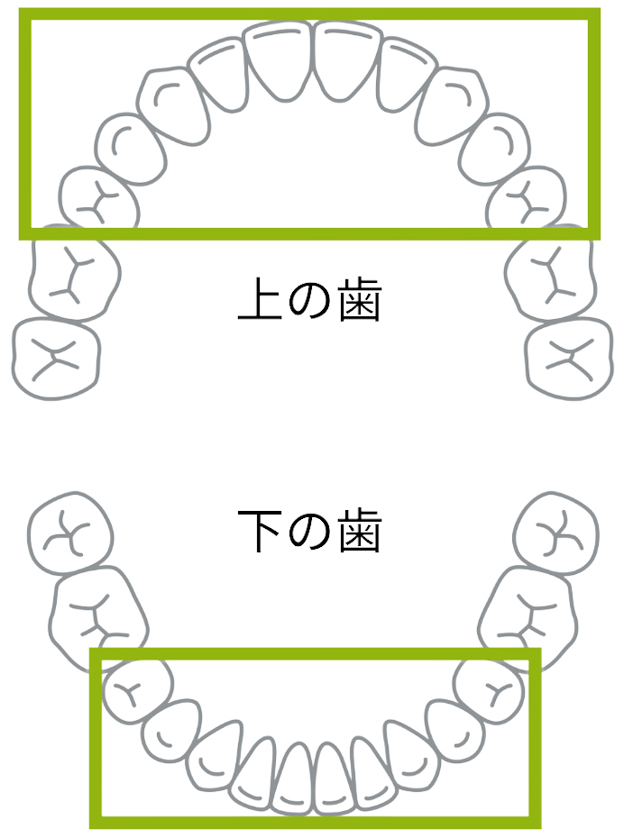 前歯の矯正-旭川市芦別市 矯正歯科相談室
