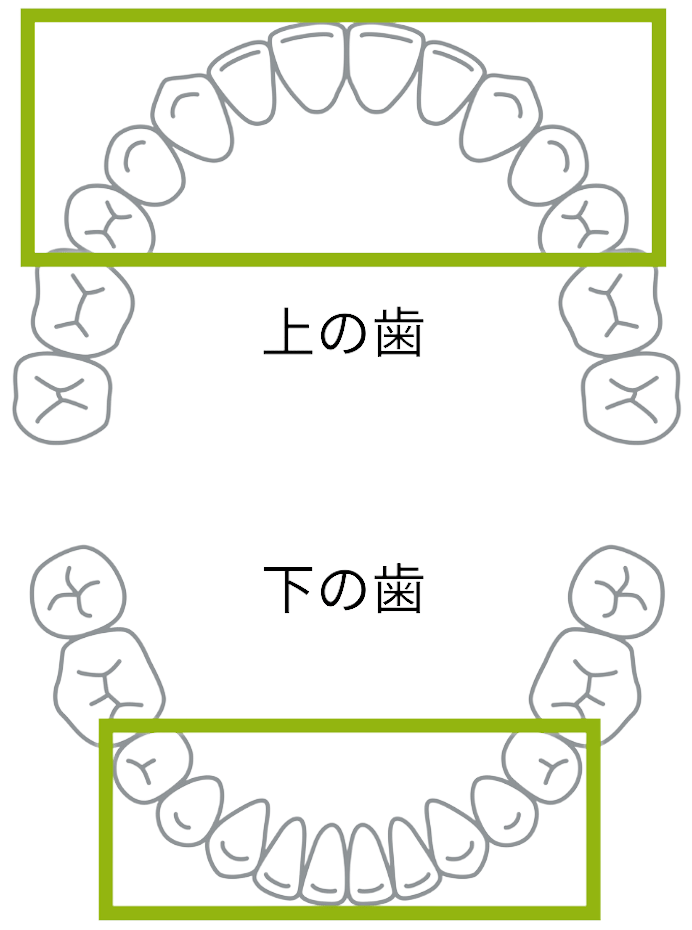 前歯の治療-旭川市芦別市 矯正歯科相談室