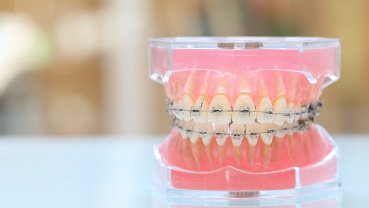 複数の治療法に対応-旭川市芦別市 矯正歯科相談室